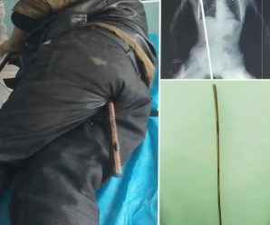 Joven hospitalizado tras ser pen…Ver más