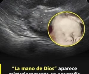 La imagen dejó sin palabras a todos: la ecografía captó lo imposible mientras la mam…Ver más