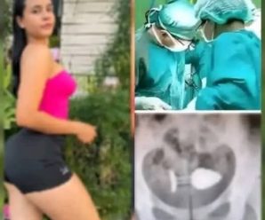 😱Chica fue h0spitalizada por pr0bar un p…Ver más