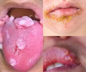 Consecuencias de besar con… Ver más