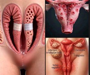 Estas son las consecuencias de tener relaciones frecuentes por… Ver más