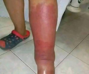 Estos son los primeros síntomas de una… Ver más