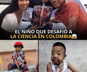 🧬 LA LUCHA DE ZAHID: EL ÚNICO CASO DE CUTIS LAXA EN…ver más