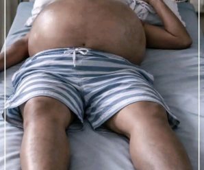 Así se ve el abdomen de un paciente que abusó del al…vermas