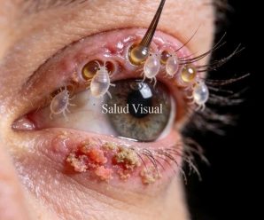Estas son las concecuencias de dormir con un… Ver más