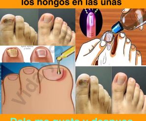 Remedio para los hongos.