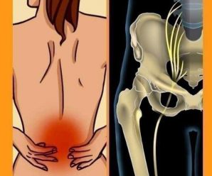 Cómo aliviar el trastorno lumbar y de ciática con estos ejercicios