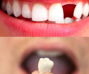 ¿Qué Significa Soñar que se te Caen los Dientes?