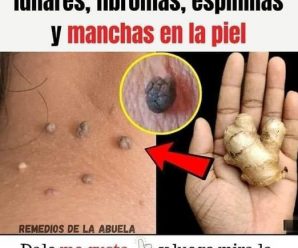 ELIMINA LAS VERRUGAS GENITALES Y FACIALES, LUNARES, FIBROMAS, ESPINILLAS Y MANCHAS DE LA EDAD CON ESTO.