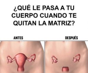 Esto le pasa al cuerpo cuando le quitan el útero