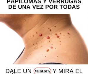 ELIMINA VERRUGAS FACIALES, LUNARES, FIBROMAS, ESPINILLAS Y MANCHAS, CON ESTO