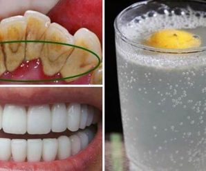 QUITA EL SARRO DE TUS DIENTES Y BLANQUÉALOS CON ESTA SIMPLE RECETA.