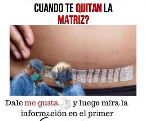 ¿Qué le sucede tu cuerpo cuando te quitan la matriz?