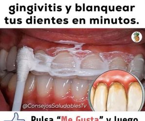 QUITA EL SARRO DE TUS DIENTES Y BLANQUÉALOS CON ESTA SIMPLE RECETA.