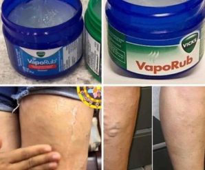 Tengo 35 años y mis muslos y piernas estaban llenas de Várices 😱 pero gracias a Dios esta receta con Vicks Vaporub elimin0 t0do. Receta en el primer comentario…