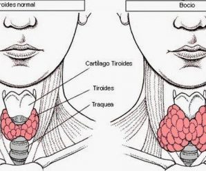 YA BASTA DE MEDICAMENTOS Y DOCTORES MINTIENDO, LA CURA PARA LA TIROIDES LA TIENE USTED EN SU CASA