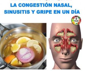 Arranca la flema de los pulmones, mejora la tos, gripe, y trata la sinusitis