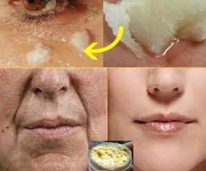 Gel casero poderoso, combate las arrugas, ojeras manchas y reafirma el rostro.