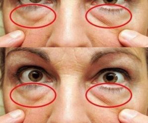 Detiene las ojeras, bolsas y párpados caídos