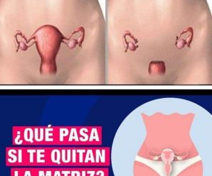 ¿Qué le sucede tu cuerpo cuando te quitan la matriz?