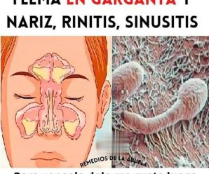 Arranca la flema de los pulmones, mejora la tos, gripe, y trata la sinusitis