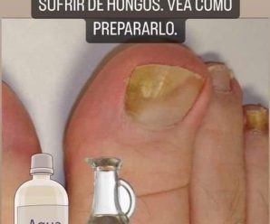 Remedio natural para ayudar a eliminar el hongo en las uñas