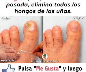 Esto se llama “el Rompedor de hongos”, porque elimina todo el hongo de las uñas de un pasado