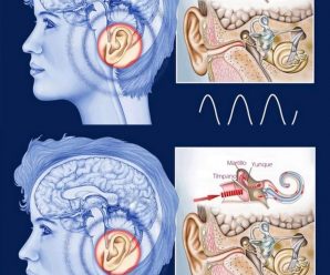 ¿POR QUÉ SIENTO UN ZUMBIDO EN EL OÍDO? CAUSAS Y LAS SOLUCIONES