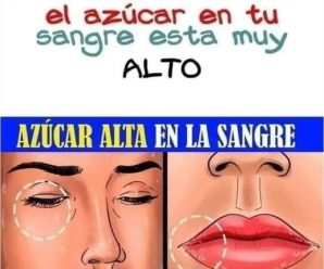 10 signos que aparecen cuando el nivel de azúcar en la sangre es muy alto y como reconocerlos