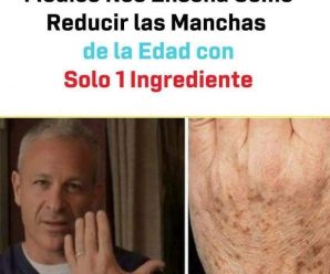 Doctor mostró receta con estos ingredientes para reducir manchas de la edad.