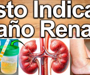 5 SINTOMAS DE DAÑO RENAL – Problema De Riñones Y Como Solucionarlo