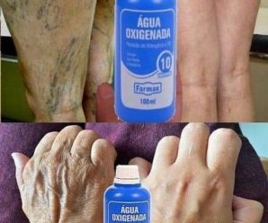 20 increíbles trucos con Agua Oxigenada, no vas a creer los usos que se le puede dar!