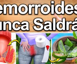 HEMORROIDES COMO SE QUITAN – Tratamiento Natural Que Cura Las Almorranas o Hemorroides