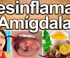 DESINFLAMA TUS AMIGDALAS EN 1 DIA – Como Eliminar La Amigdalitis O Inflamación De La Garganta