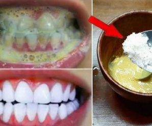 Quita el sarro de tus dientes y blanquéalos con esta simple receta.