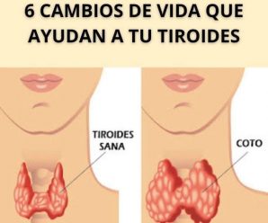 6 CAMBIOS EN EL ESTILO DE VIDA QUE AYUDAN A TU TIROIDES