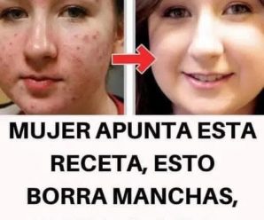 Mascarilla de aspirina para embellecer la piel