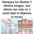 Quita el sarro de tus dientes y blanquéalos con esta simple receta.