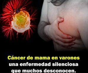 Cáncer de mama en varones: una enfermedad silenciosa que muchos desconocen.