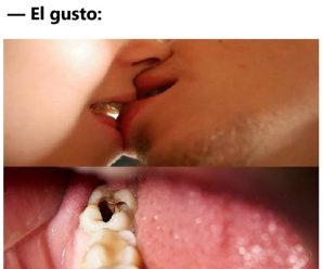 Científicos revelan que la causa del Alzheimer podría ser una periodontitis crónica.