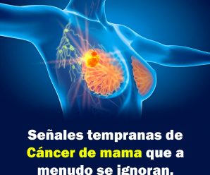 Señales tempranas de cáncer de mama que a menudo se ignoran.