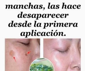 Eliminar las manchas de la cara es posible, con esta loción casera de perejil