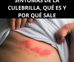Todo lo que debes saber sobre el Herpes Zóster: causas, detección y tratamientos naturales-