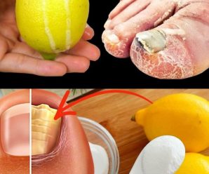 “Limón y Bicarbonato: Tu Solución Natural para Combatir los Hongos”