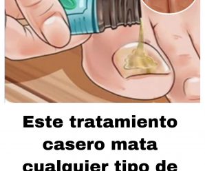 Combate los hongos.