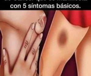 Signos y síntomas de la leucemia linfocítica aguda