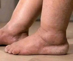 8 Síntomas de que tu Sistema Linfático Está Tóxico y Fallando