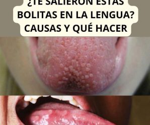 Si Tienes Granitos en la Lengua, Tu Cuerpo Te Está Avisando Que Algo Anda Mal