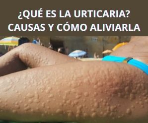 Le Picaba Todo el Cuerpo: Lo que Creía una Alergia Común Ocultaba Algo Más Serio