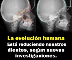 La evolución humana está reduciendo nuestros dientes, según nuevas investigaciones.